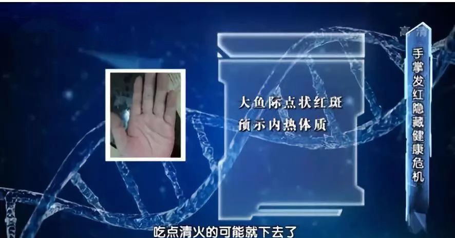 血管好不好 看手就知道!这5个地方长青筋太危险 可能突发心脑血管疾病!休闲区蓝鸢梦想 - Www.slyday.coM 血管好不好 看手就知道!这5个地方长青筋太危险 可能突发心脑血管疾病!休闲区蓝鸢梦想 - Www.slyday.coM