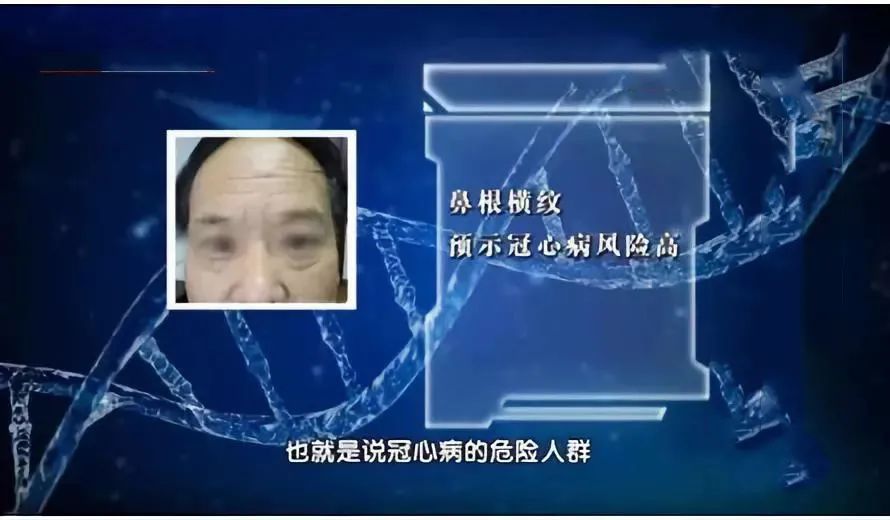 血管好不好 看手就知道!这5个地方长青筋太危险 可能突发心脑血管疾病!休闲区蓝鸢梦想 - Www.slyday.coM 血管好不好 看手就知道!这5个地方长青筋太危险 可能突发心脑血管疾病!休闲区蓝鸢梦想 - Www.slyday.coM