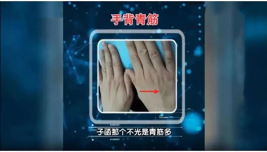 血管好不好 看手就知道!这5个地方长青筋太危险 可能突发心脑血管疾病!休闲区蓝鸢梦想 - Www.slyday.coM 血管好不好 看手就知道!这5个地方长青筋太危险 可能突发心脑血管疾病!休闲区蓝鸢梦想 - Www.slyday.coM