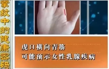 血管好不好 看手就知道!这5个地方长青筋太危险 可能突发心脑血管疾病!休闲区蓝鸢梦想 - Www.slyday.coM 血管好不好 看手就知道!这5个地方长青筋太危险 可能突发心脑血管疾病!休闲区蓝鸢梦想 - Www.slyday.coM