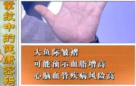 血管好不好 看手就知道!这5个地方长青筋太危险 可能突发心脑血管疾病!休闲区蓝鸢梦想 - Www.slyday.coM 血管好不好 看手就知道!这5个地方长青筋太危险 可能突发心脑血管疾病!休闲区蓝鸢梦想 - Www.slyday.coM