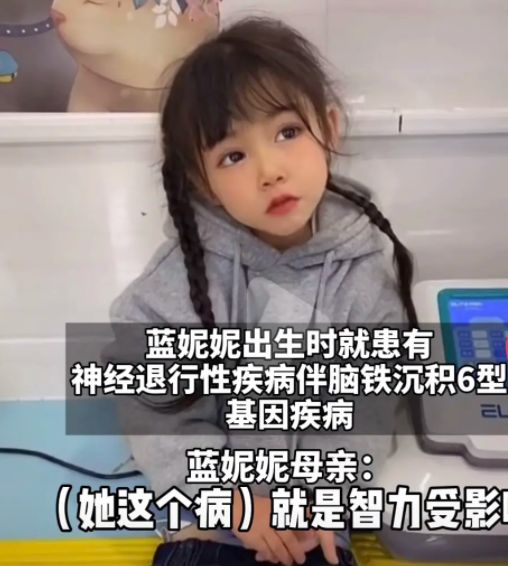 蓝妮妮患罕见基因病有逆天颜值无自理能力被誉无声天使