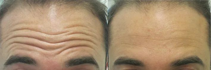 抬头纹,用它→休闲区蓝鸢梦想 - Www.slyday.coM 抬头纹,用它→休闲区蓝鸢梦想 - Www.slyday.coM