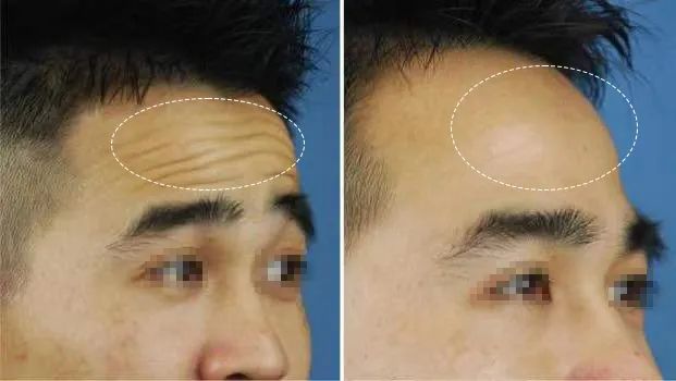 抬头纹,用它→休闲区蓝鸢梦想 - Www.slyday.coM 抬头纹,用它→休闲区蓝鸢梦想 - Www.slyday.coM