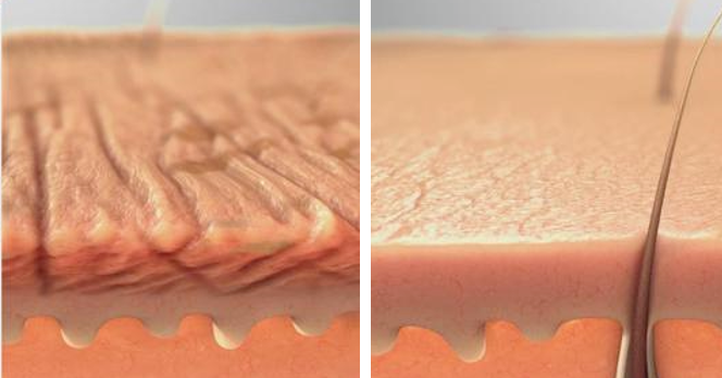 抬头纹,用它→休闲区蓝鸢梦想 - Www.slyday.coM 抬头纹,用它→休闲区蓝鸢梦想 - Www.slyday.coM