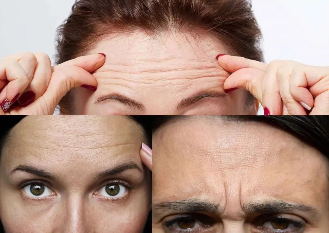 抬头纹,用它→休闲区蓝鸢梦想 - Www.slyday.coM 抬头纹,用它→休闲区蓝鸢梦想 - Www.slyday.coM