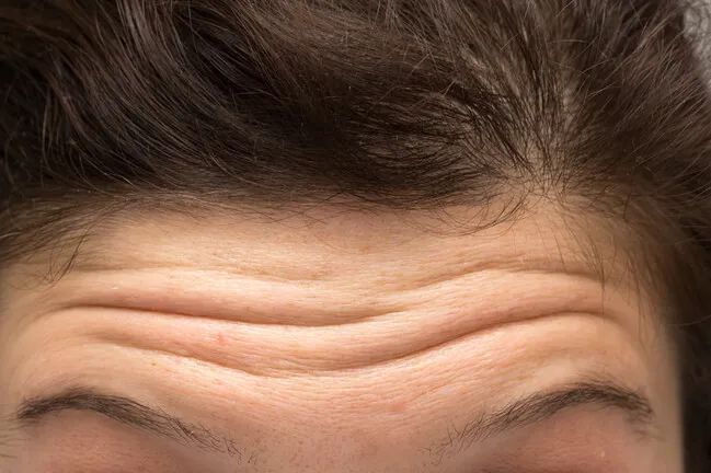 抬头纹,用它→休闲区蓝鸢梦想 - Www.slyday.coM 抬头纹,用它→休闲区蓝鸢梦想 - Www.slyday.coM