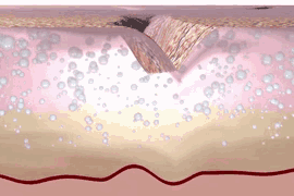 抬头纹,用它→休闲区蓝鸢梦想 - Www.slyday.coM 抬头纹,用它→休闲区蓝鸢梦想 - Www.slyday.coM