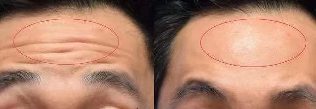 抬头纹,用它→休闲区蓝鸢梦想 - Www.slyday.coM 抬头纹,用它→休闲区蓝鸢梦想 - Www.slyday.coM