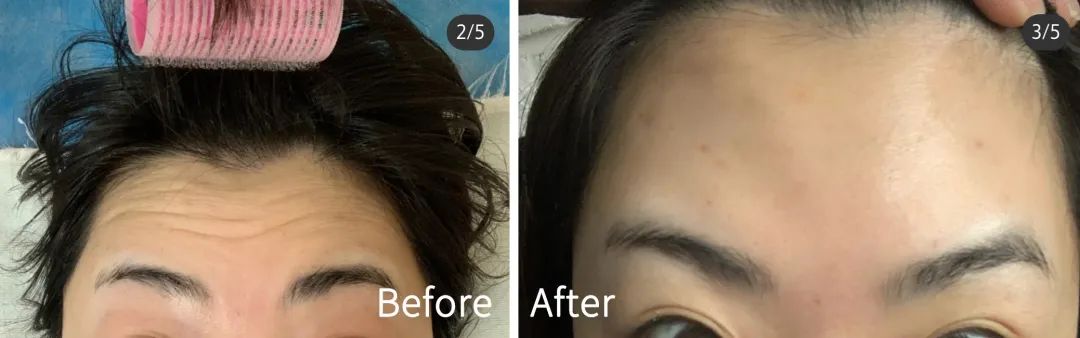 抬头纹,用它→休闲区蓝鸢梦想 - Www.slyday.coM 抬头纹,用它→休闲区蓝鸢梦想 - Www.slyday.coM