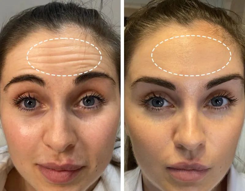 抬头纹,用它→休闲区蓝鸢梦想 - Www.slyday.coM 抬头纹,用它→休闲区蓝鸢梦想 - Www.slyday.coM