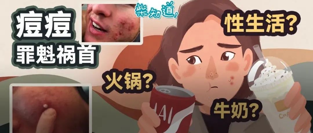 挑完讽刺痘痘能不能吃牛肉火锅？