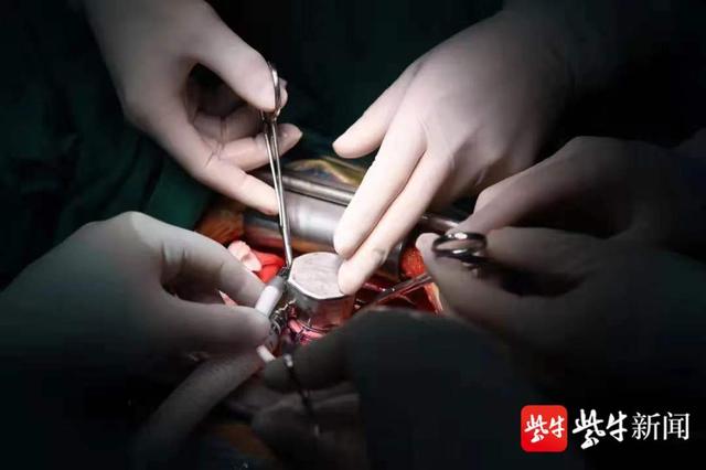 江苏首例!南京市第一医院成功植入全球最小的“人工心脏”休闲区蓝鸢梦想 - Www.slyday.coM 江苏首例!南京市第一医院成功植入全球最小的“人工心脏”休闲区蓝鸢梦想 - Www.slyday.coM