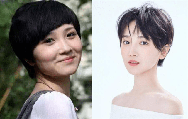 [转载]5位拿命变美的女星，因塑身衣皮肤溃烂、吃药物长瘤，是疯了吗？