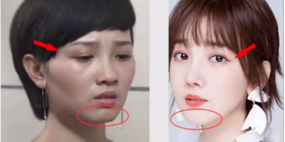 [转载]5位拿命变美的女星，因塑身衣皮肤溃烂、吃药物长瘤，是疯了吗？