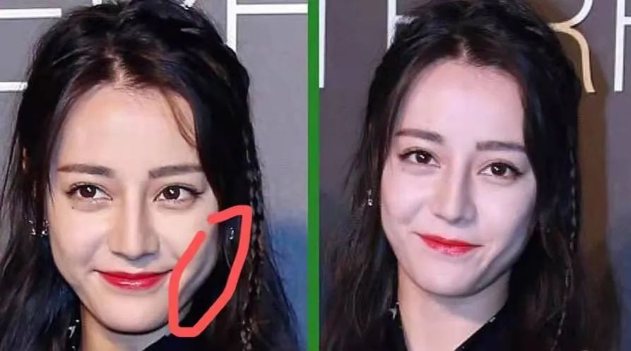 五官好看，“吃亏”在脸上，热巴脸颊凹陷，鞠婧祎颧骨突出