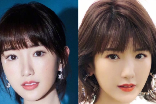 成功减龄or发面馒头？女星热衷的饱满苹果肌，一不小心成“灾难”