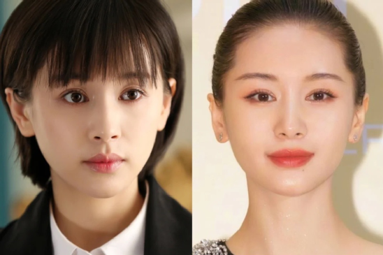 成功减龄or发面馒头？女星热衷的饱满苹果肌，一不小心成“灾难”