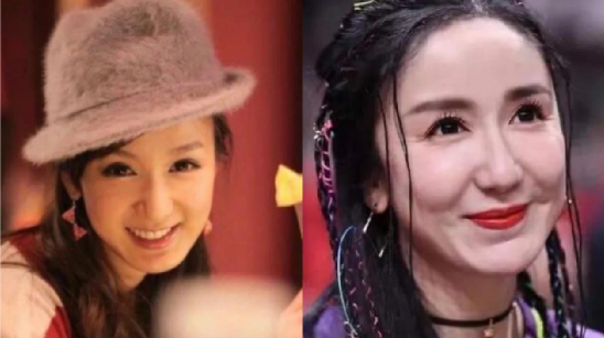 成功减龄or发面馒头？女星热衷的饱满苹果肌，一不小心成“灾难”