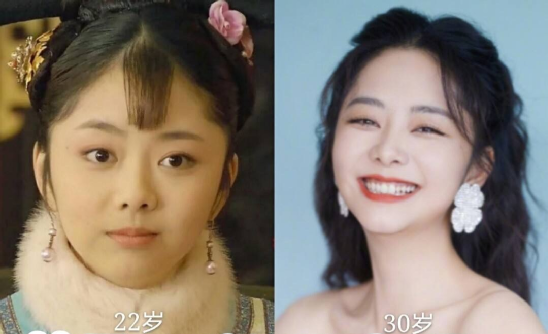 成功减龄or发面馒头？女星热衷的饱满苹果肌，一不小心成“灾难”