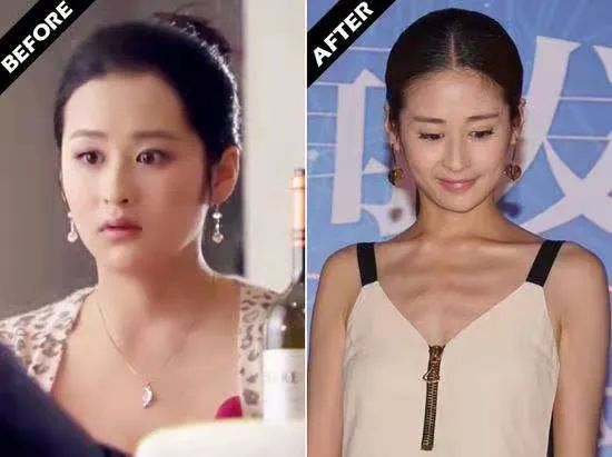 明星审美误区，杨紫靠打针填充变“好看”，吴谨言追求“骨感美”