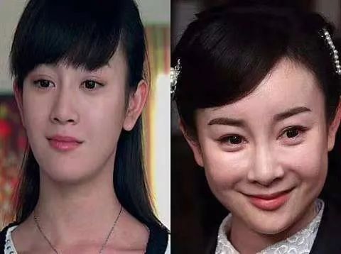 明星审美误区，杨紫靠打针填充变“好看”，吴谨言追求“骨感美”