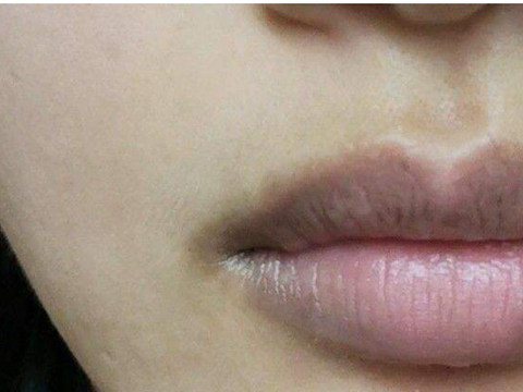 嘴唇发黑什么原因 嘴唇乌黑怎么回事