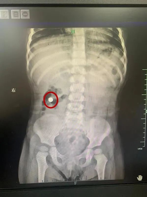 洗衣凝露当糖果?1岁男童吞下大半包休闲区蓝鸢梦想 - Www.slyday.coM 洗衣凝露当糖果?1岁男童吞下大半包休闲区蓝鸢梦想 - Www.slyday.coM