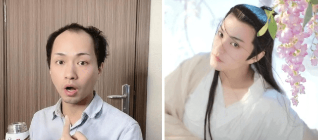 30岁“秃头大叔”惊天逆袭，被<a href=