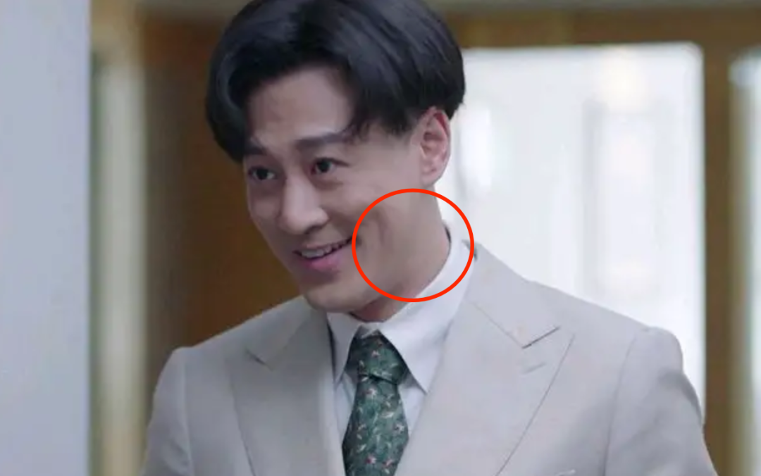 TVB小生也老得快，黄宗泽满脸褶子，林峯出现整容后遗症