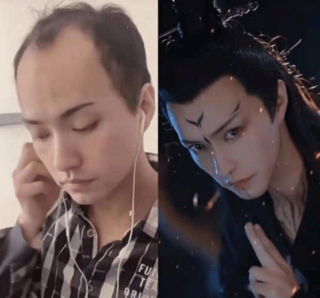 30岁“秃头大叔”惊天逆袭，被<a href=