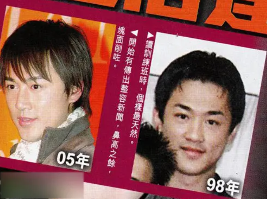TVB小生也老得快，黄宗泽满脸褶子，林峯出现整容后遗症