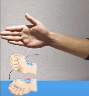 你的手部过度劳累了吗?1个动作自检腱鞘炎,常玩手机的人要注意休闲区蓝鸢梦想 - Www.slyday.coM 你的手部过度劳累了吗?1个动作自检腱鞘炎,常玩手机的人要注意休闲区蓝鸢梦想 - Www.slyday.coM