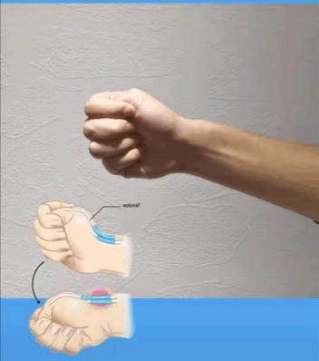 你的手部过度劳累了吗?1个动作自检腱鞘炎,常玩手机的人要注意休闲区蓝鸢梦想 - Www.slyday.coM 你的手部过度劳累了吗?1个动作自检腱鞘炎,常玩手机的人要注意休闲区蓝鸢梦想 - Www.slyday.coM