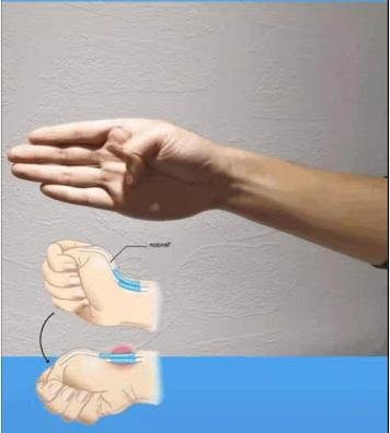 你的手部过度劳累了吗?1个动作自检腱鞘炎,常玩手机的人要注意休闲区蓝鸢梦想 - Www.slyday.coM 你的手部过度劳累了吗?1个动作自检腱鞘炎,常玩手机的人要注意休闲区蓝鸢梦想 - Www.slyday.coM