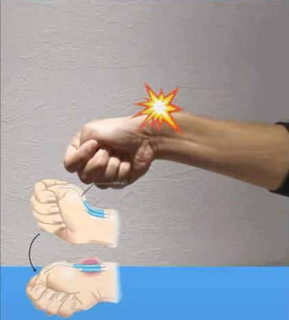 你的手部过度劳累了吗?1个动作自检腱鞘炎,常玩手机的人要注意休闲区蓝鸢梦想 - Www.slyday.coM 你的手部过度劳累了吗?1个动作自检腱鞘炎,常玩手机的人要注意休闲区蓝鸢梦想 - Www.slyday.coM