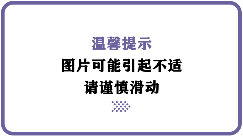 4岁男孩小肠被切除1.5米,只因一个动作:5大饭后坏习惯,真的会致命!休闲区蓝鸢梦想 - Www.slyday.coM 4岁男孩小肠被切除1.5米,只因一个动作:5大饭后坏习惯,真的会致命!休闲区蓝鸢梦想 - Www.slyday.coM