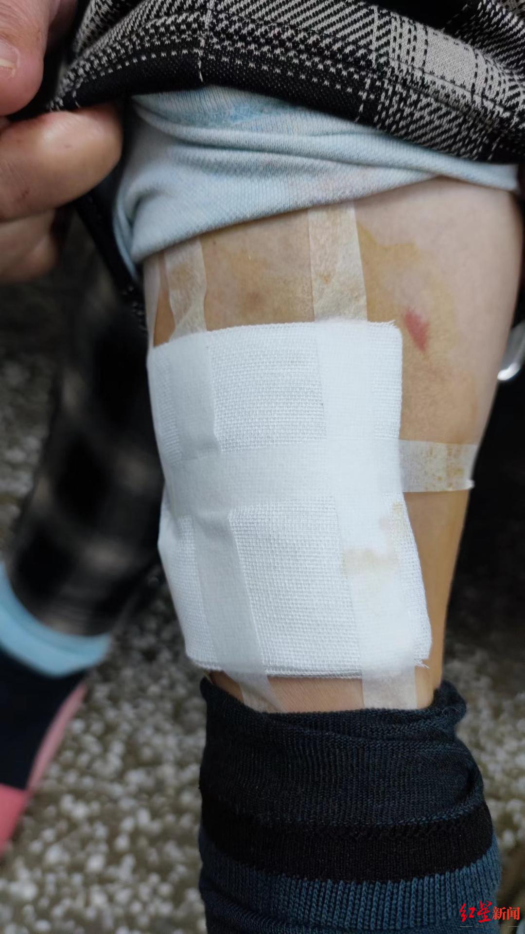 精装楼盘7个月3起浴室玻璃碎裂事件,业主称“不敢去洗澡了” 开发商:检测有问题将维修或更换休闲区蓝鸢梦想 - Www.slyday.coM 精装楼盘7个月3起浴室玻璃碎裂事件,业主称“不敢去洗澡了” 开发商:检测有问题将维修或更换休闲区蓝鸢梦想 - Www.slyday.coM