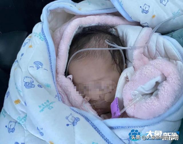 87天女婴心脏比同龄人大3倍,90后抗疫母亲跨省求援休闲区蓝鸢梦想 - Www.slyday.coM 87天女婴心脏比同龄人大3倍,90后抗疫母亲跨省求援休闲区蓝鸢梦想 - Www.slyday.coM