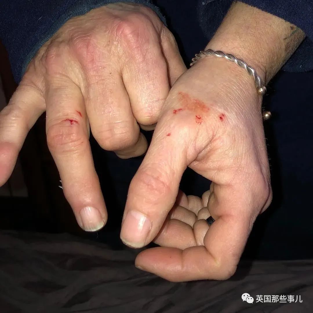 虚弱小松鼠被老奶奶捡回家,各种宠溺关爱,真成了奶奶带大的胖仔!休闲区蓝鸢梦想 - Www.slyday.coM 虚弱小松鼠被老奶奶捡回家,各种宠溺关爱,真成了奶奶带大的胖仔!休闲区蓝鸢梦想 - Www.slyday.coM