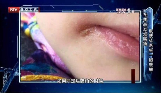 常做这些动作的人,你一直在“毁健康”!第一个就很多人中招!休闲区蓝鸢梦想 - Www.slyday.coM 常做这些动作的人,你一直在“毁健康”!第一个就很多人中招!休闲区蓝鸢梦想 - Www.slyday.coM