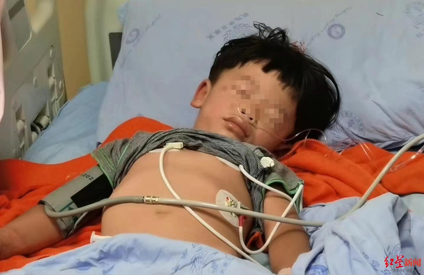 恐怖蚂蚁!西昌男童被红火蚁咬伤休克紧急送医脱险 医生:红火蚁已进入活跃期休闲区蓝鸢梦想 - Www.slyday.coM 恐怖蚂蚁!西昌男童被红火蚁咬伤休克紧急送医脱险 医生:红火蚁已进入活跃期休闲区蓝鸢梦想 - Www.slyday.coM