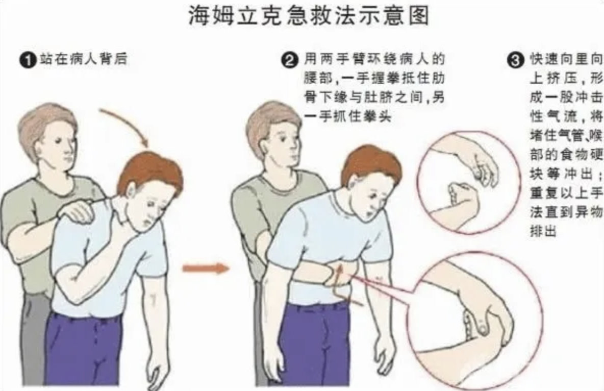 学生不慎被杏卡喉执勤民警飞奔施救,一定要学会海姆立克急救法休闲区蓝鸢梦想 - Www.slyday.coM 学生不慎被杏卡喉执勤民警飞奔施救,一定要学会海姆立克急救法休闲区蓝鸢梦想 - Www.slyday.coM