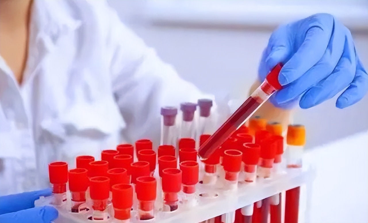 血型可以决定大脑衰老的速度?哪种血型不易患老年痴呆?该相信吗休闲区蓝鸢梦想 - Www.slyday.coM 血型可以决定大脑衰老的速度?哪种血型不易患老年痴呆?该相信吗休闲区蓝鸢梦想 - Www.slyday.coM