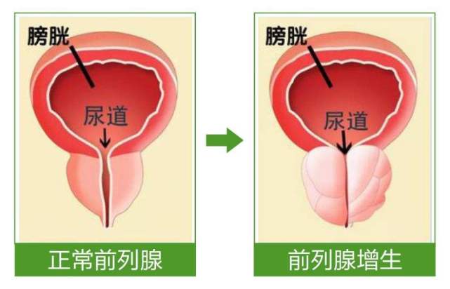 学到了吗（50岁男人雄性激素分泌旺盛是什么原因造成的）50岁雄性激素分泌旺盛怎么办，男性雄激素越旺盛越好吗？实话实说：50岁后，可能会带来3大问题，戒色后头发会恢复吗男，