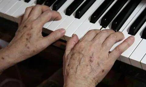 90后姑娘熬夜10年长出老年斑,原因竟然是这个!休闲区蓝鸢梦想 - Www.slyday.coM 90后姑娘熬夜10年长出老年斑,原因竟然是这个!休闲区蓝鸢梦想 - Www.slyday.coM