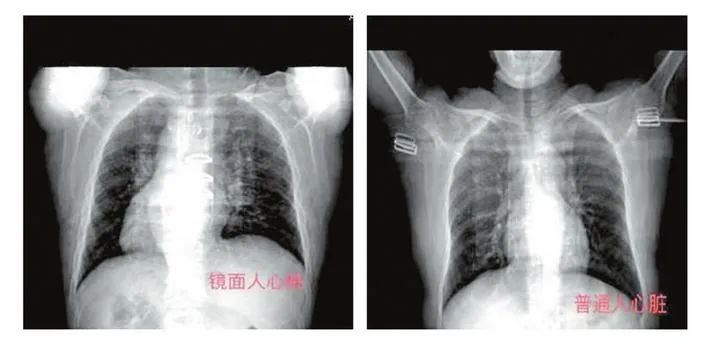 罕见!芜湖一男子五脏六腑全“长反”?这台手术不简单休闲区蓝鸢梦想 - Www.slyday.coM 罕见!芜湖一男子五脏六腑全“长反”?这台手术不简单休闲区蓝鸢梦想 - Www.slyday.coM