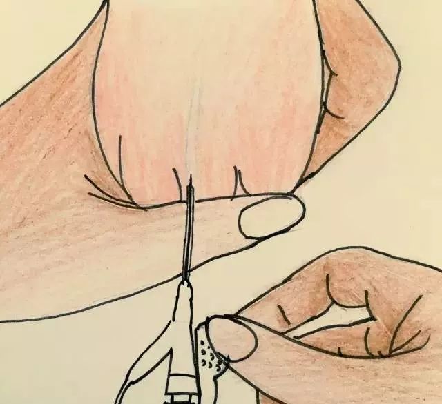 护士手绘新生儿扎针流程,这是一个被护士耽误了的画家吧?!休闲区蓝鸢梦想 - Www.slyday.coM 护士手绘新生儿扎针流程,这是一个被护士耽误了的画家吧?!休闲区蓝鸢梦想 - Www.slyday.coM