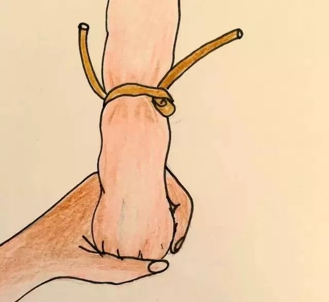 护士手绘新生儿扎针流程,这是一个被护士耽误了的画家吧?!休闲区蓝鸢梦想 - Www.slyday.coM 护士手绘新生儿扎针流程,这是一个被护士耽误了的画家吧?!休闲区蓝鸢梦想 - Www.slyday.coM