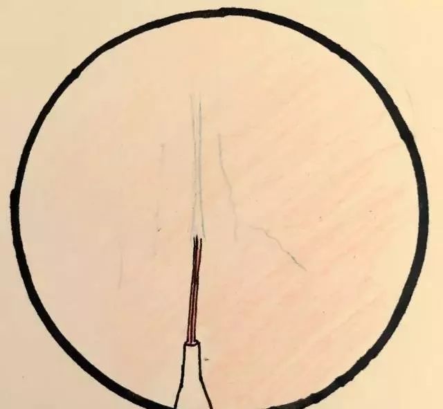 护士手绘新生儿扎针流程,这是一个被护士耽误了的画家吧?!休闲区蓝鸢梦想 - Www.slyday.coM 护士手绘新生儿扎针流程,这是一个被护士耽误了的画家吧?!休闲区蓝鸢梦想 - Www.slyday.coM